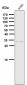 Anti-NGFR/P75 Rabbit Monoclonal Antibody